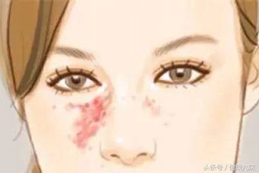 郑家伟治疗血管畸形怎么样,郑家伟婴幼儿血管瘤共识