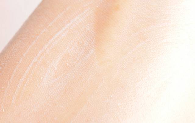 宝宝烧伤应该抹什么药膏,宝宝烧伤结痂应该抹什么药膏