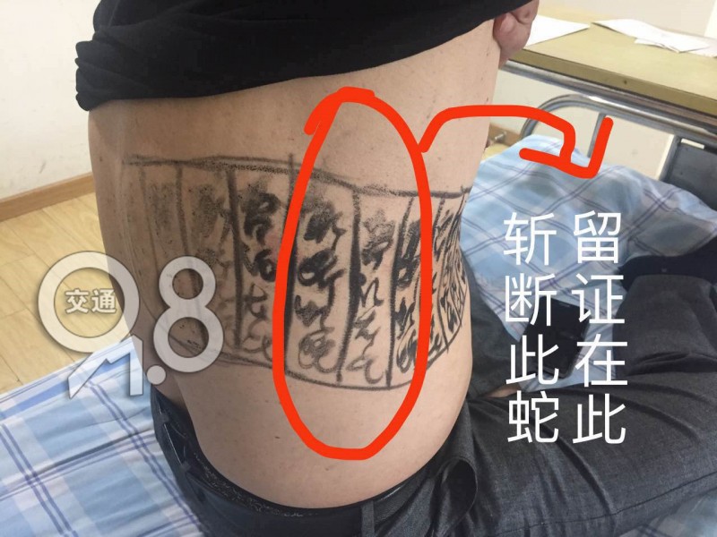 萧山大爷在自己腰上画符,用来治这种病!结果惨了……