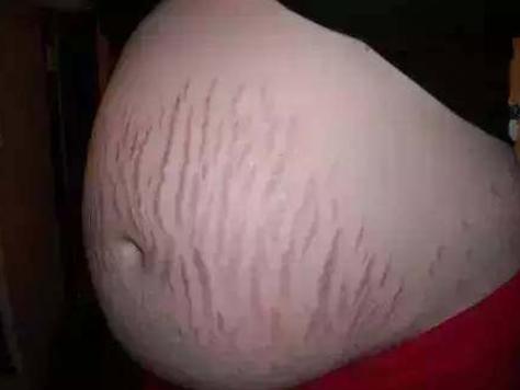 Angelababy产后素颜出席活动，身体这一部位足以看出她生过孩子，网友指责黄晓明