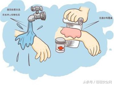 宝宝被油烫了有红印怎么办,被油烫伤怎么办最快最有效