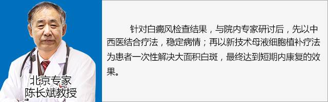 白癜风有没自愈的病例,白癜风治愈一百例