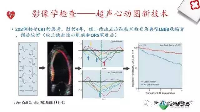 「心声」从机制到临床，一起认识左束支阻滞！