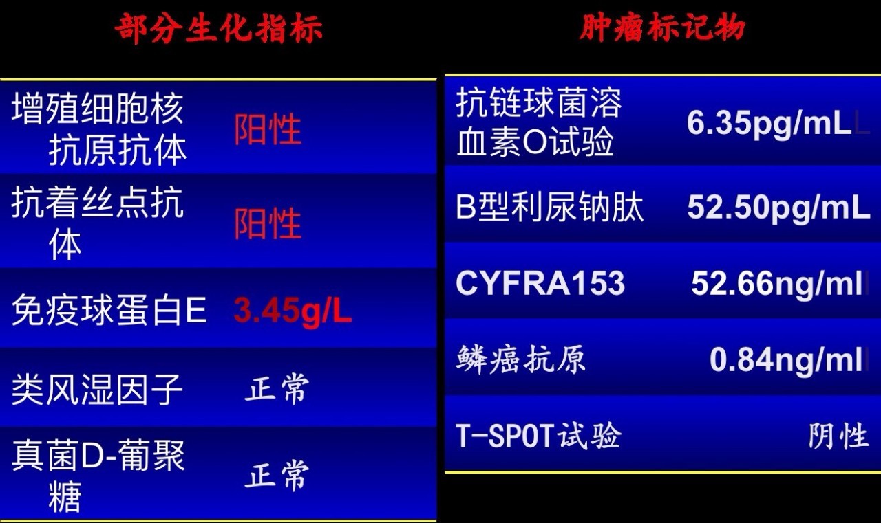 喘息、呼衰1年，问病史才发现是这个病！