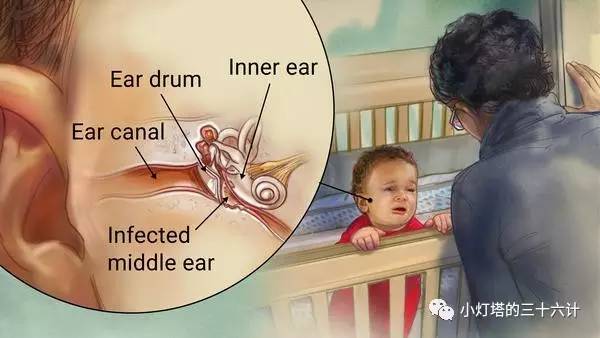 敲黑板幼儿园,婴幼儿常见疾病和家庭防护