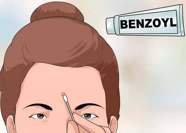 黑头痘痘粉刺脓包囊肿去除过程,脸上频繁长脓包痘痘是什么原因