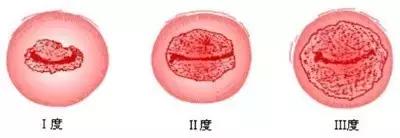 陪闺蜜看妇科，顺道“长”了知识！