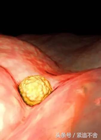 超萌龙凤胎宝宝图片,孕1到9周胎儿发育全过程