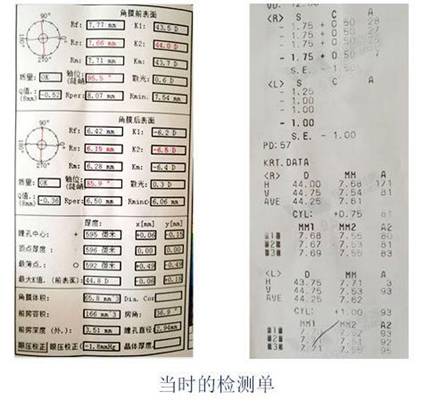 近视了家长不让戴眼镜,孩子近视家长不给戴眼镜怎么办