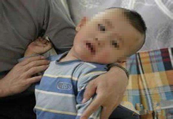 2岁宝宝走路一瘸一拐，医生竟从宝宝脚底取出一根针！