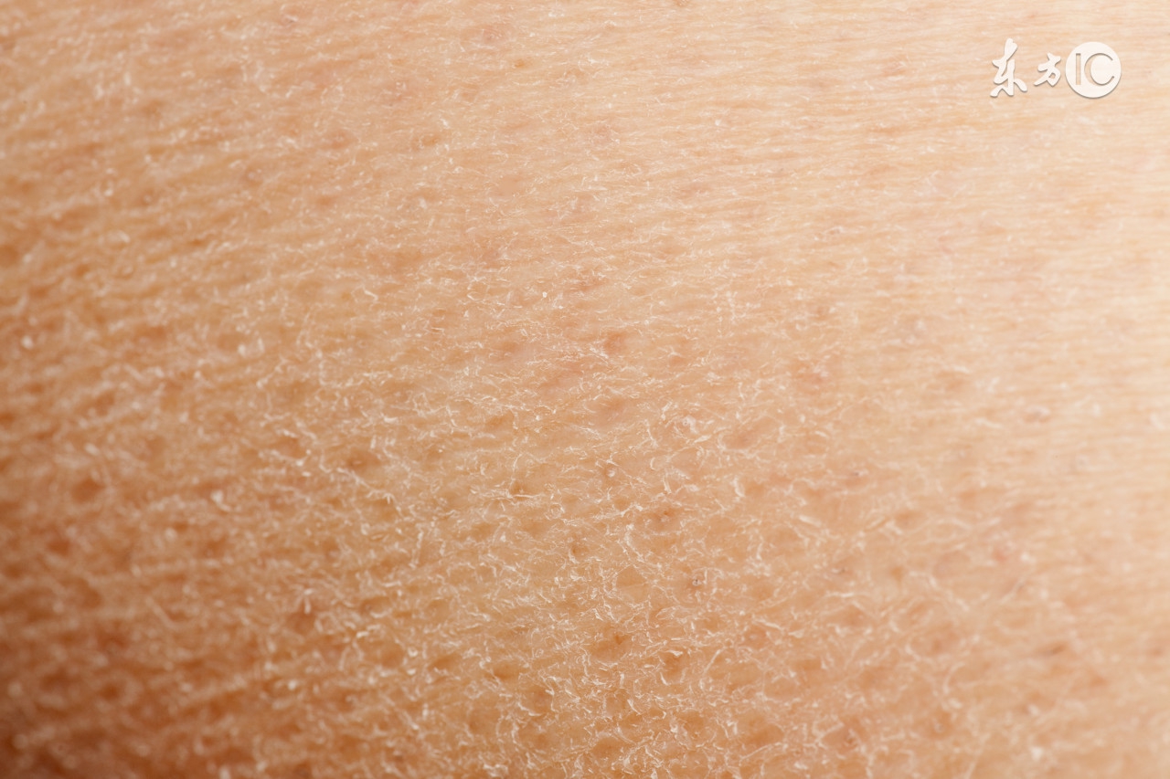 夏天皮肤瘙痒有红疹是什么原因,夏天皮肤瘙痒是什么原因