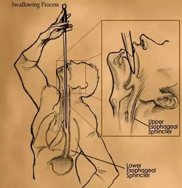 胃镜全过程科普,做胃镜的六大知识