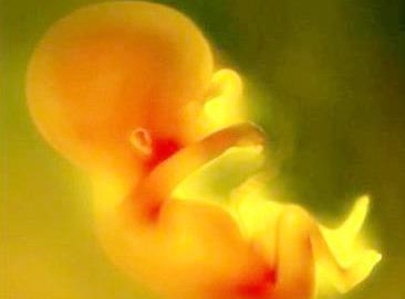 孕早期胎停有什么反应和症状,孕早期出现胎停会有什么症状