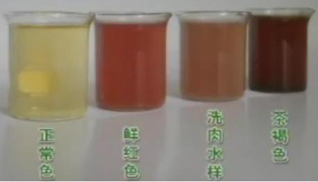 肾病尿检有什么指标是异常的,尿检肾早期损伤指标