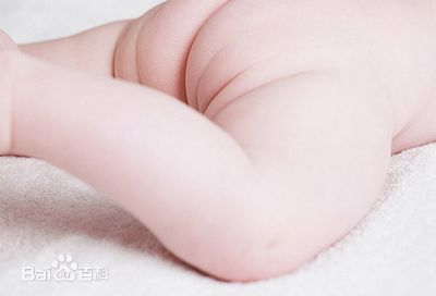 怎么护理一岁多的宝宝红屁屁,如何护理宝宝红屁屁破皮