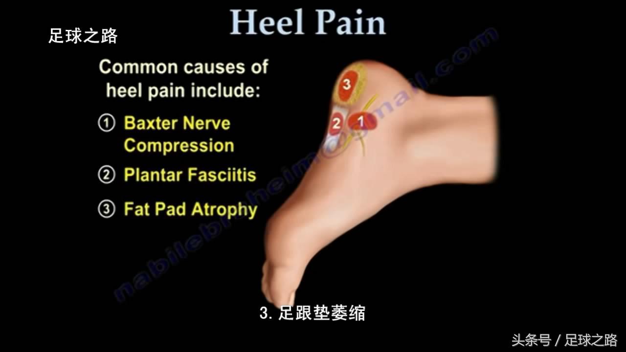 足跟痛的症状及表现,足跟痛最常见病因