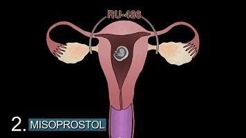 LAN《性、安全、录像带》
