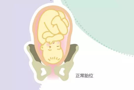 预产期快到了胎位不正怎么办,快到预产期了胎位不正怎么办