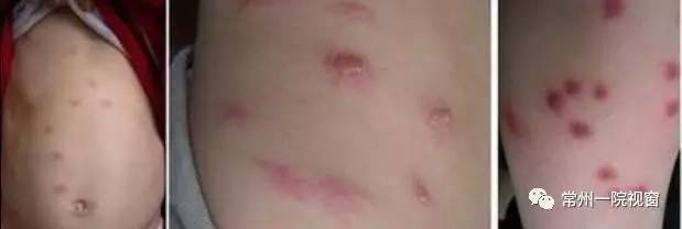 生活不止眼前的艰难还有诗与远方,生活不止梅雨季还有艳阳天