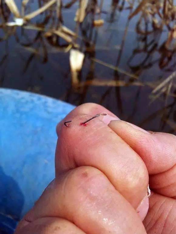 鱼钩倒刺刺进肉里怎么弄出来,有倒刺的鱼钩扎到肉如何取