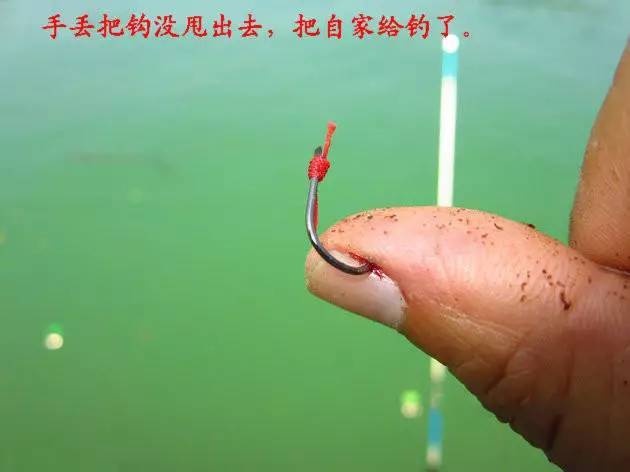 鱼钩倒刺刺进肉里怎么弄出来,有倒刺的鱼钩扎到肉如何取
