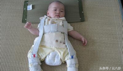 小孩双腿关节不对称,幼儿腿关节有响声挂什么科