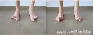 怎么站立可以改善足弓塌陷,如何站立练背