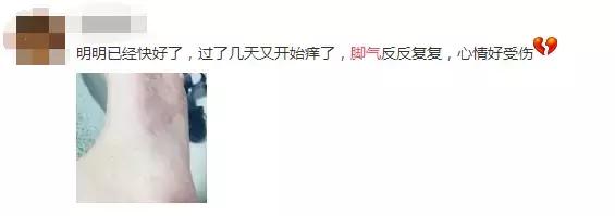 快！闻闻你的脚！听说大部分武汉伢都有脚气