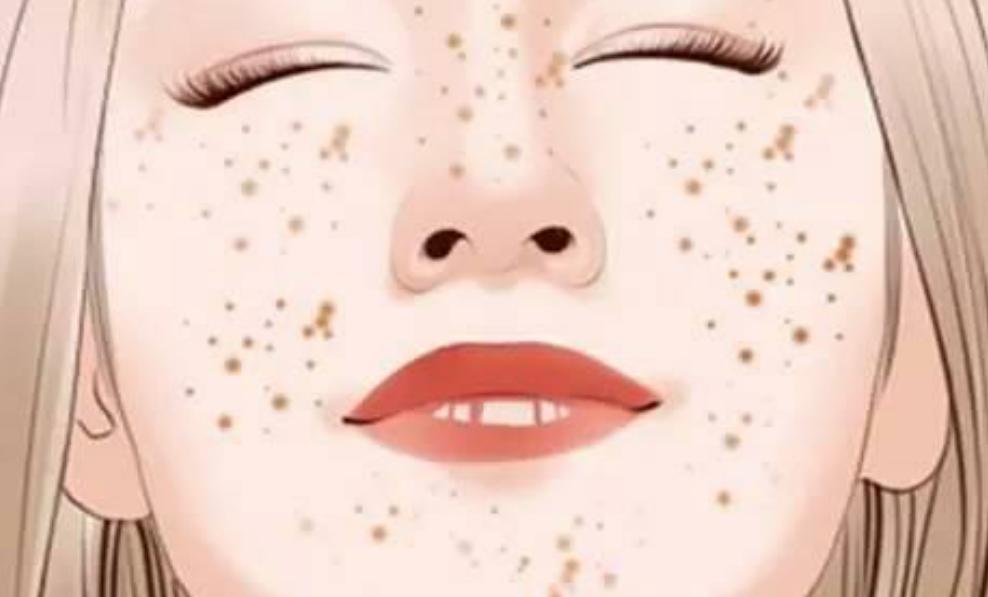 雀斑黄褐斑去除最快的方法,雀斑黄褐斑去除方法