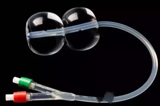 生孩子一定要塞球囊吗,生孩子要塞纱布吗