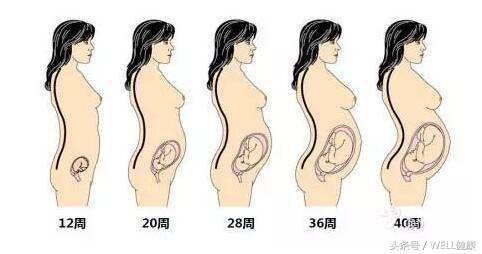 备孕腰椎间盘突出怎么办,腰椎间盘突出可以备孕吗