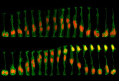 大脑皮层占大脑总量的多少,关于大脑皮层的知识