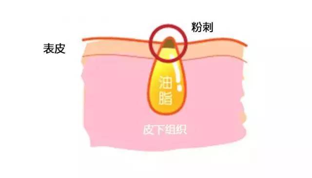 最新外国大战的场面,老外大战