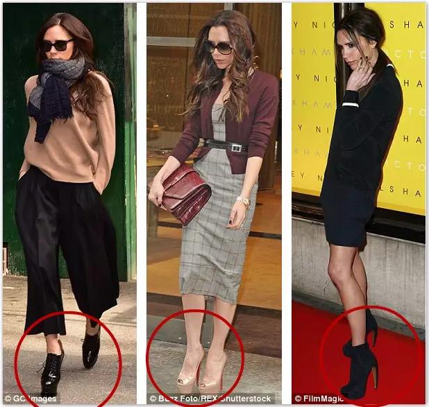 贝克汉姆的脚变形,贝克汉姆老婆脚外翻