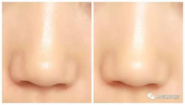 什么方法可以让皮肤嫩嫩滑滑,如何让皮肤光滑得像剥了壳的鸡蛋