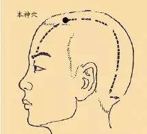 刘红云针灸顽固性失眠,顽固性失眠针灸穴位