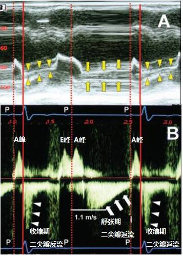 必杀技完整电影版,必杀技一招致命