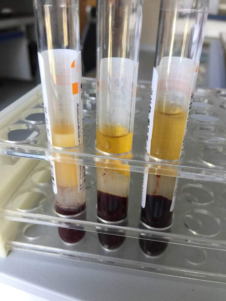 准妈妈们要注意了,准妈妈们这些孕期知识一定要注意