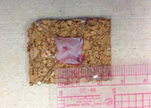 内镜下肌切开术手术步骤,肌肉活检最新技术