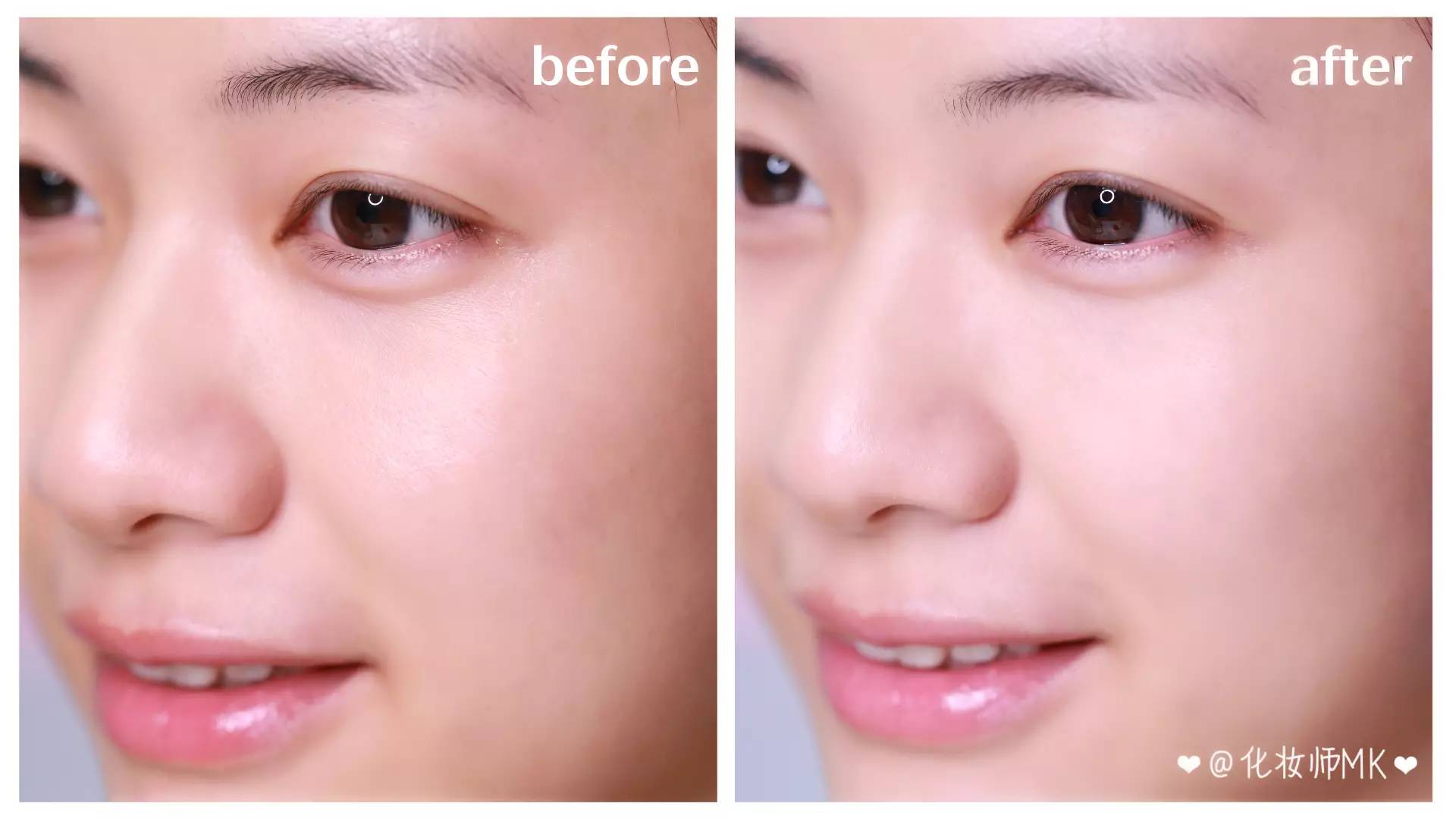 有没有去除脸部皱纹的小神器,改善脸部细纹推荐