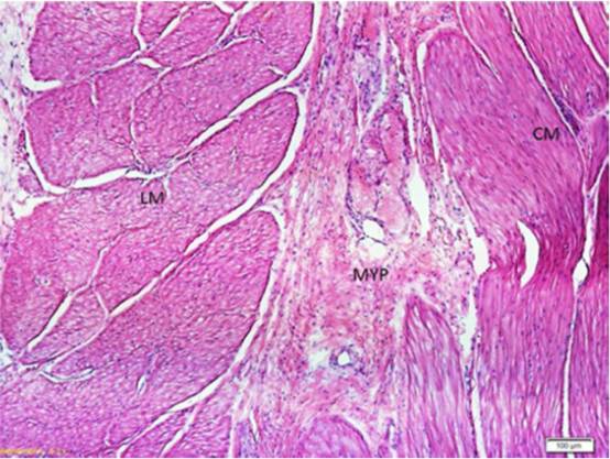 内镜下肌切开术手术步骤,肌肉活检最新技术