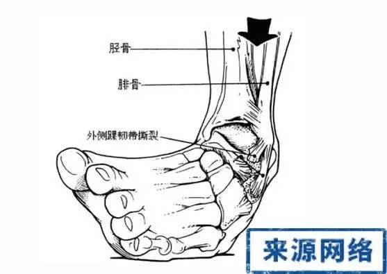 天气凉注意保护膝盖,冬天脚踝保护方法
