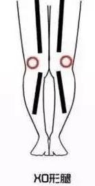 男士腿不直适合穿什么样的裤子,大腿粗腿短的女生适合什么裤子