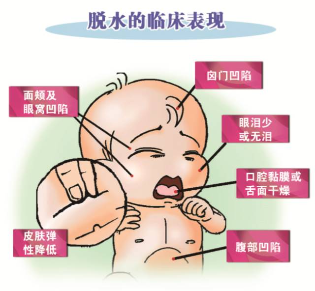 宝宝上吐下泻要警惕诺如病毒侵袭,儿童上吐下泻是不是轮状病毒