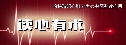 室早三联律是什么原因造成的,读心有术讲的是什么