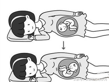 胎宝宝太懒不爱动,孕晚期臀位宝宝可以顺产吗