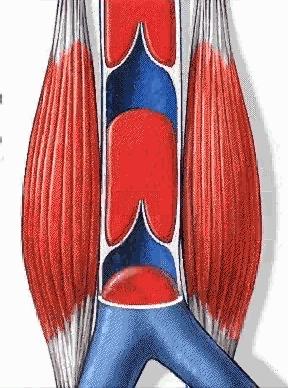 脑血栓是怎样形成的?与3种血管病变有关,用4招可预防