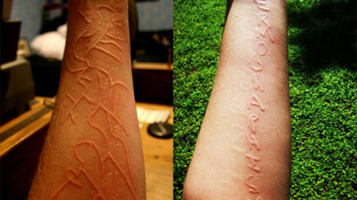 没被*麻疹荨**痒死，差点被老专家忽悠死