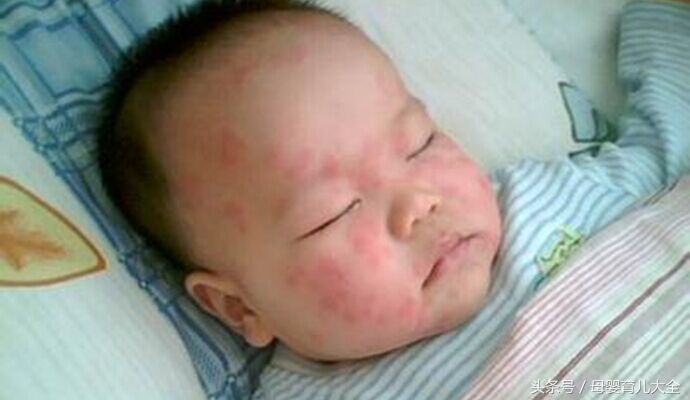回了趟老家身上起疙瘩,宝宝回老家身上就出疙瘩怎么办