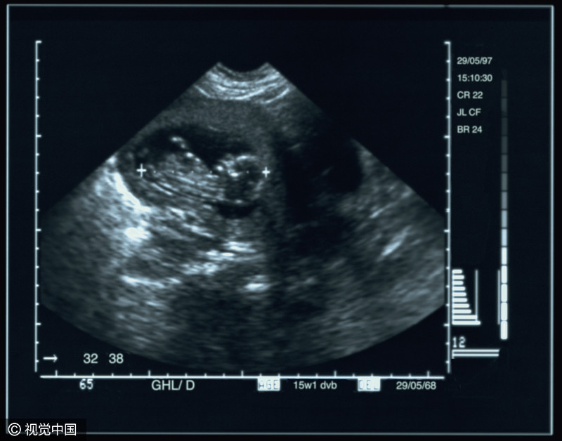 巴西夫妇生15个娃组足球队,巴西一对夫妇生15个孩子